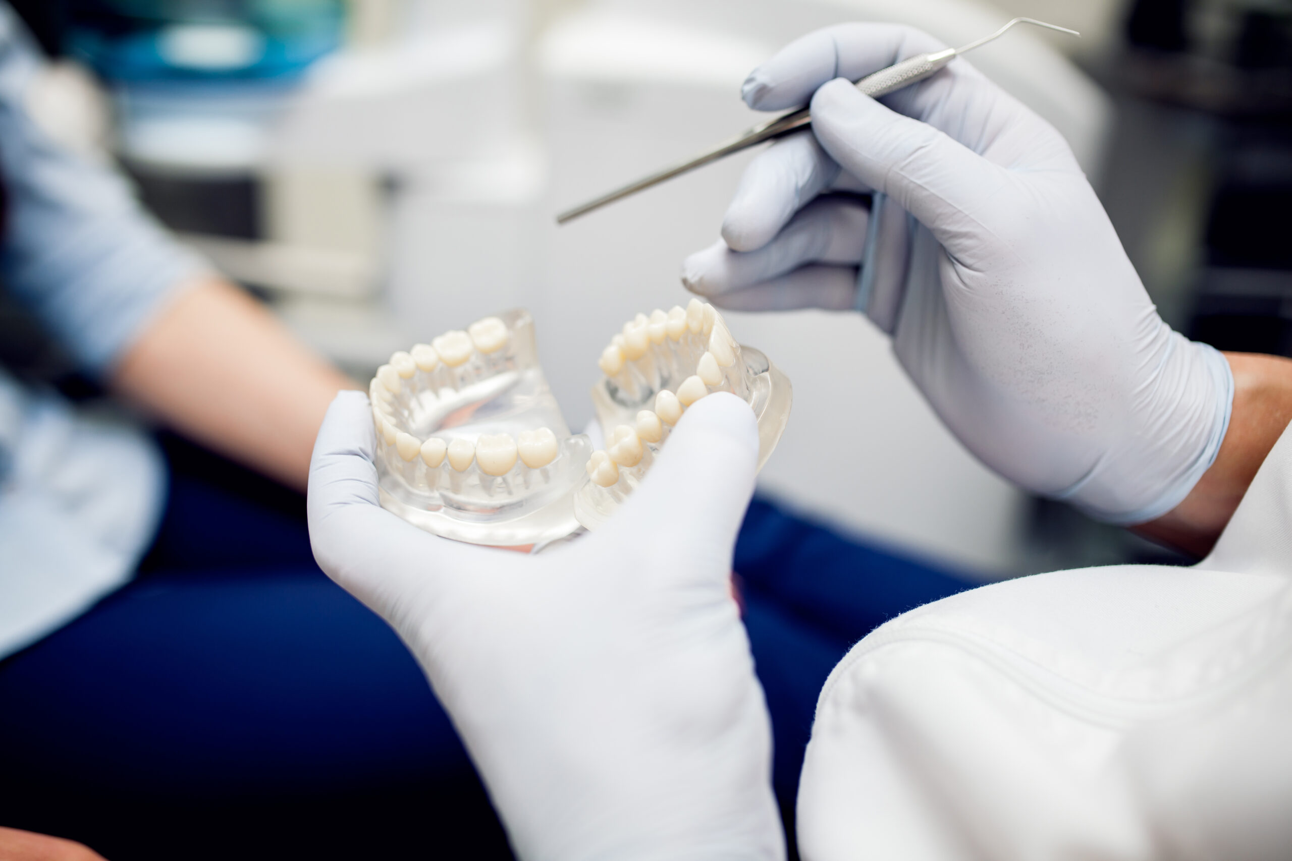 ¿Qué son los implantes dentales?